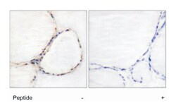 AHR Rabbit anti-Human, Mouse, Rat, Polyclonal Antibody, Abnova 100&mu;g;