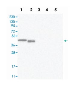 TXNDC13 Rabbit anti-Human, Polyclonal Antibody, Abnova 100&mu;L; Unlabeled:Antibodies,
