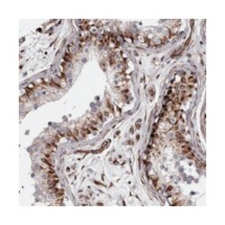 C17orf70 Rabbit anti-Human, Polyclonal Antibody, Abnova 100&mu;L; Unlabeled:Antibodies,