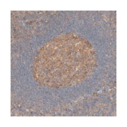 VEPH1, Rabbit, Polyclonal Antibody, Abnova 100&mu;L; Unlabeled:Antibodies,