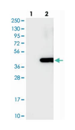 BCKDHB, Rabbit, Polyclonal Antibody, Abnova 100&mu;L; Unlabeled:Antibodies,