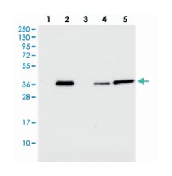 BCO2 Rabbit anti-Human, Polyclonal Antibody, Abnova 100 &mu;L | Buy Online | Abnova Corporation | Fisher Scientific