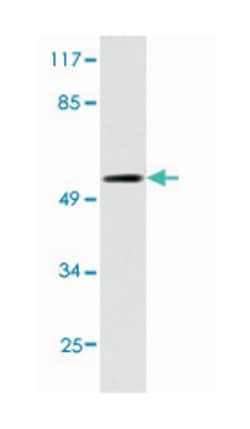 CHEK1 Rabbit anti-Human, Polyclonal Antibody, Abnova 100 &mu;L | Buy Online | Abnova Corporation | Fisher Scientific