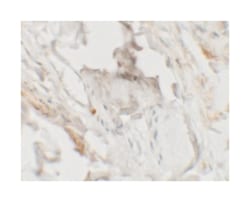 HHATL Rabbit anti-Human, Mouse, Rat, Polyclonal Antibody, Abnova 100 &mu;g | Buy Online | Abnova Corporation | Fisher Scientific