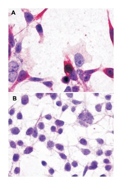 GRM3 Rabbit anti-Bovine, Hamster, Horse, Human, Monkey, Mouse, Pig, Rat,