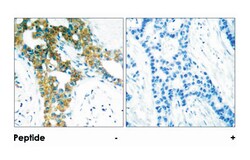 PAK1/PAK2/PAK3 Rabbit anti-Human, Mouse, Rat, Polyclonal Antibody, Abnova 100 &mu;g | Buy Online | Abnova | Fisher Scientific