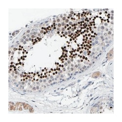 CREM, Rabbit, Polyclonal Antibody, Abnova 100&mu;L; Unlabeled:Antibodies,