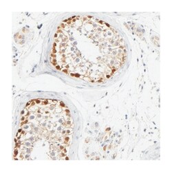 ASB9 Rabbit anti-Human, Polyclonal Antibody, Abnova 100&mu;L; Unlabeled:Antibodies,