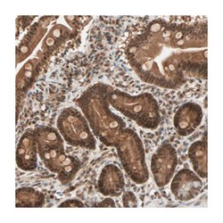 ZNF44, Rabbit, Polyclonal Antibody, Abnova 100&mu;L; Unlabeled:Antibodies,