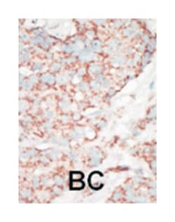 STK25 Rabbit anti-Human, Polyclonal Antibody, Abnova 400 &mu;L | Buy Online | Abnova Corporation | Fisher Scientific