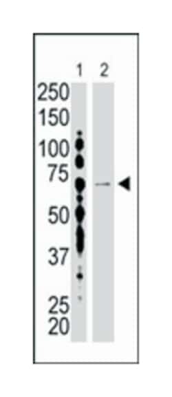 USP2 Rabbit anti-Human, Polyclonal Antibody, Abnova 400 &mu;L | Buy Online | Abnova Corporation | Fisher Scientific