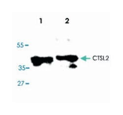 CTSL2, Rabbit, Polyclonal Antibody, Abnova 100&mu;g; Unlabeled:Antibodies,