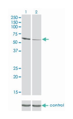 RIO kinase 3 (yeast), Mouse, Clone: 3G11, Abnova 100&mu;g; Unlabeled:Antibodies,