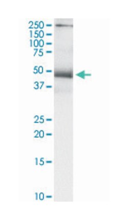 tumor necrosis factor receptor superfamily, member 10b, Rabbit, Purified