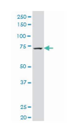 guanine monphosphate synthetase, Mouse, Polyclonal Antibody, Abnova 50&mu;L;