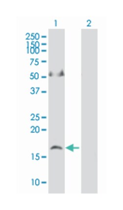 apelin, Mouse, Polyclonal Antibody, Abnova 50&mu;L; Unlabeled:Antibodies,