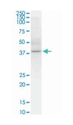 sphingosine kinase 1, Mouse, Clone: 1D6, Abnova 100&mu;g; Unlabeled:Antibodies,
