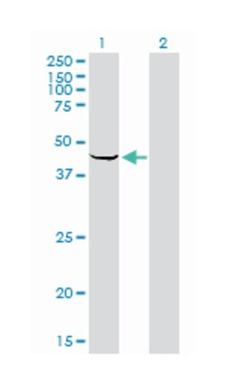 sphingosine kinase 1, Mouse, Clone: 1D6, Abnova 100&mu;g; Unlabeled:Antibodies,