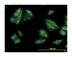 Abnova Corporation&nbsp;sequestosome 1, Mouse, Clone: 2C11, Abnova&trade;
