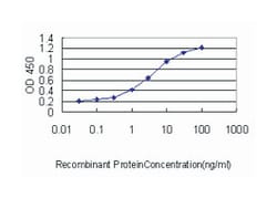 sequestosome 1, Mouse, Clone: 2C11, Abnova 100&mu;g; Unlabeled:Antibodies,