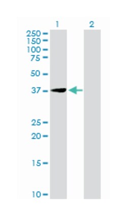eukaryotic translation initiation factor 2B, subunit 2 beta, 39kDa, Rabbit,