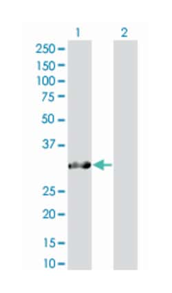 SNRPN upstream reading frame, Mouse, Polyclonal Antibody, Abnova&trade;