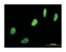 SNRPN upstream reading frame, Mouse, Polyclonal Antibody, Abnova&trade;
