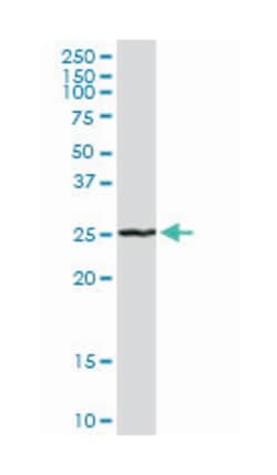 RAB7, member RAS oncogene family-like 1, Rabbit, Purified MaxPab Polyclonal Antibody, Abnova 100 &mu;g | Buy Online | Abnova Corporation | Fisher Scientific