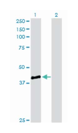 starch binding domain 1, Rabbit, Purified MaxPab Polyclonal Antibody, Abnova