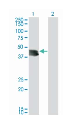 starch binding domain 1, Mouse, Clone: 4H4, Abnova 100 &mu;g | Buy Online | Abnova Corporation | Fisher Scientific