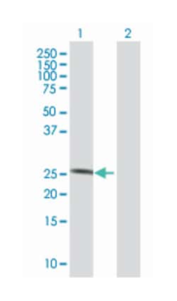 peptidoglycan recognition protein 1, Mouse, Polyclonal Antibody, Abnova