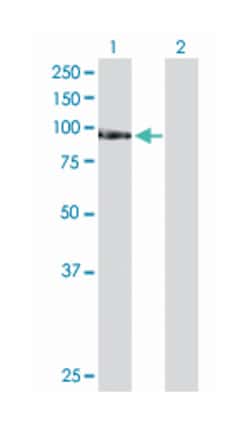 TATA box binding protein (TBP)-associated factor, RNA polymerase I, C,