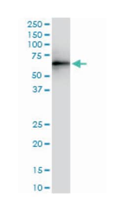 ubiquitin specific peptidase 14 (tRNA-guanine transglycosylase) (A01), Mouse anti-Human, Mouse, Rat, Polyclonal Antibody, Abnova™