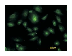 hepatocyte growth factor-regulated tyrosine kinase substrate, Mouse, Clone: