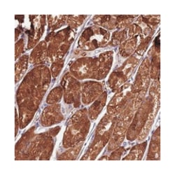TBC1D24, Rabbit, Polyclonal Antibody, Abnova 100 &mu;L | Buy Online | Abnova Corporation | Fisher Scientific