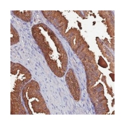 OR56B1, Rabbit, Polyclonal Antibody, Abnova 100 &mu;L | Buy Online | Abnova Corporation | Fisher Scientific