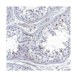 CATSPER4, Rabbit, Polyclonal Antibody, Abnova 100 &mu;L | Buy Online | Abnova Corporation | Fisher Scientific