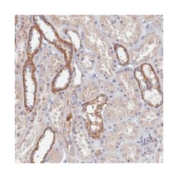 KRCC1, Rabbit, Polyclonal Antibody, Abnova 100 &mu;L | Buy Online | Abnova Corporation | Fisher Scientific