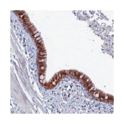 SLC25A37 Rabbit anti-Human, Polyclonal Antibody, Abnova 100 &mu;L | Buy Online | Abnova Corporation | Fisher Scientific