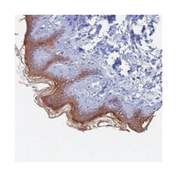 KRT77, Rabbit, Polyclonal Antibody, Abnova 100 &mu;L | Buy Online | Abnova Corporation | Fisher Scientific