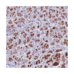 BEST2 Rabbit anti-Human, Polyclonal Antibody, Abnova 100 &mu;L | Buy Online | Abnova Corporation | Fisher Scientific