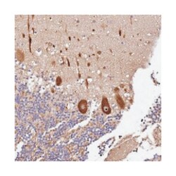 DDX27, Rabbit, Polyclonal Antibody, Abnova 100&mu;L; Unlabeled:Antibodies,