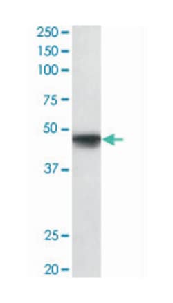 POU3F1 Goat anti-Human, Polyclonal Antibody, Abnova 100 &mu;g | Buy Online | Abnova Corporation | Fisher Scientific