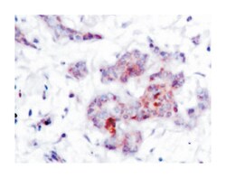 REL Rabbit anti-Human, Polyclonal Antibody, Abnova 100 &mu;L | Buy Online | Abnova Corporation | Fisher Scientific