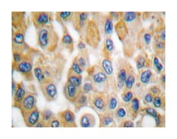 COX2, Rabbit, Polyclonal Antibody, Abnova 100&mu;L; Unlabeled:Antibodies,