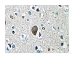 AKAP1, Rabbit, Polyclonal Antibody, Abnova 100 &mu;L | Buy Online | Abnova Corporation | Fisher Scientific