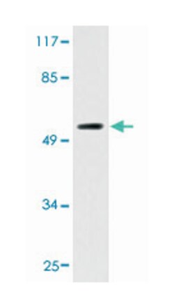 CYP2D6, Rat, Polyclonal Antibody, Abnova 100 &mu;L | Buy Online | Abnova Corporation | Fisher Scientific