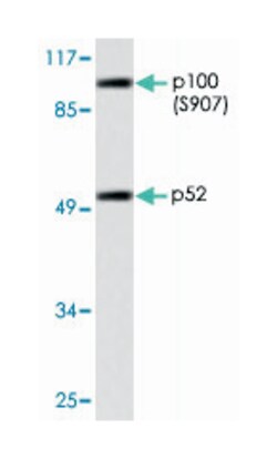 NFKB1 (phospho S907), Rabbit anti-Human, Polyclonal Antibody, Abnova 100&mu;L;