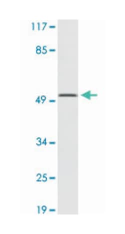 CA9 Rabbit anti-Human, Polyclonal Antibody, Abnova 100 &mu;L | Buy Online | Abnova Corporation | Fisher Scientific