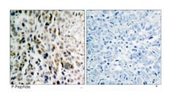 CHEK2 (phospho T68), Rabbit anti-Human, Mouse, Rat, Polyclonal Antibody,